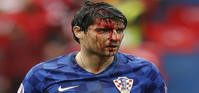 اصابة دموية للاعب كرواتيا امام تركيا