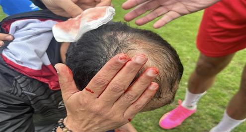 لحظة إصابة مدرب الافريقي التونسي في مباراة الأولمبي الباجي