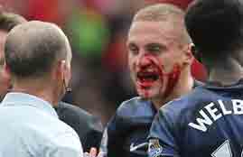 دماء فيديتش