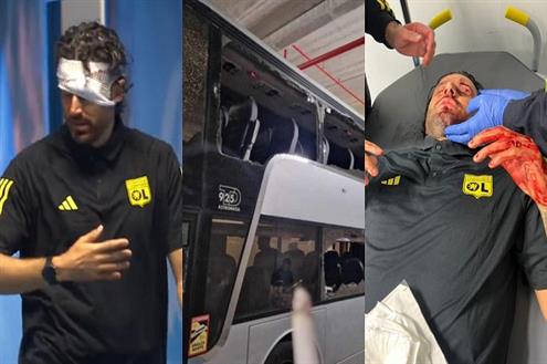 لحظة اعتداء جماهير مارسيليا على حافلة ليون