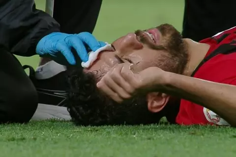 إصابة قوية لتريزيجيه في مباراة نادي قطر