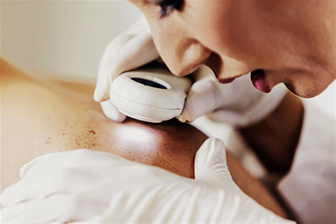 493ss_getty_rf_dermatologist_checking_skin
