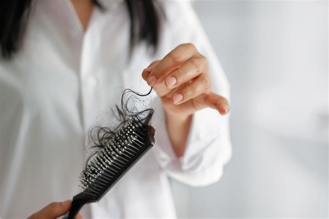 woman-losing-hair-on-hairbrush-in-hand-on-bathroom-royalty-free-image-846216978-1539032249