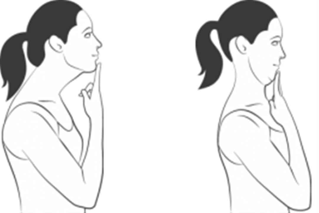 Chin-Tuck-exercise