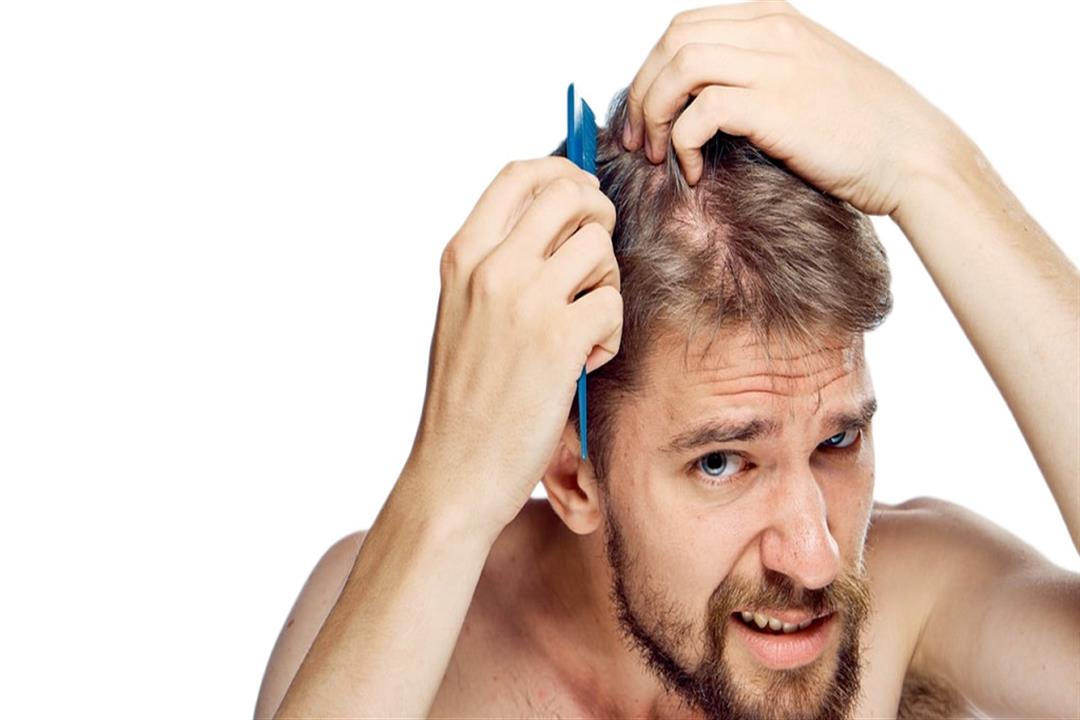علاجات بديلة لتساقط الشعر عند الرجال                                                                                                                                                                    