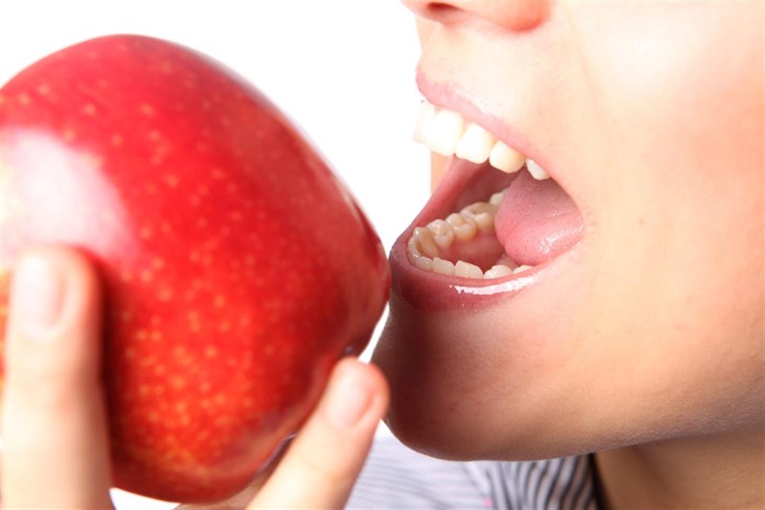 أضرار التفاح على الأسنان
