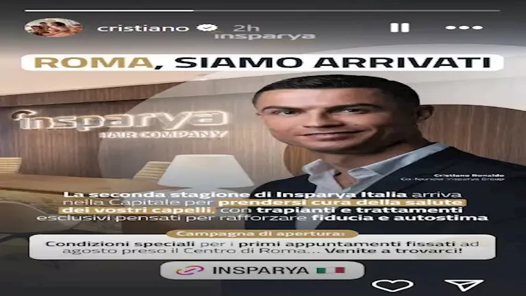 مشروع رونالدو لزراعة الشعر