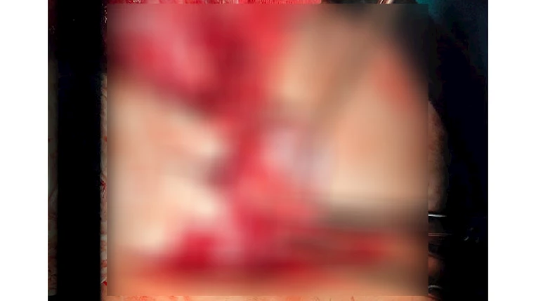 1000698627