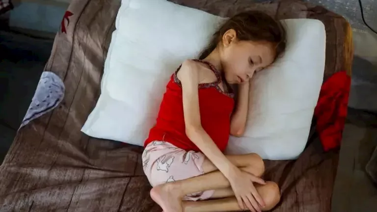 جنى عياد تتلقى العلاج من سوء التغذية في مستشفى في دير البلح