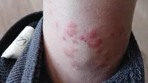 صورة 1 جنود الاحتلال