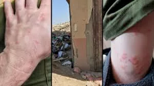 صورة 3 جنود الاحتلال