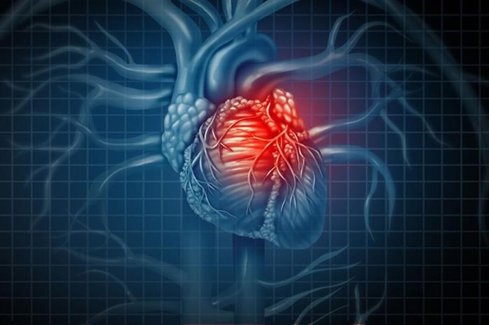 دراسة تكشف العلاقة بين نقص الحديد في منتصف العمر وأمراض القلب