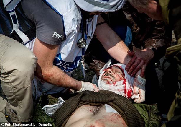 صحفي روسي يصاب بجروح بالغة بعد سيره على لغم                                                                                                                                                             