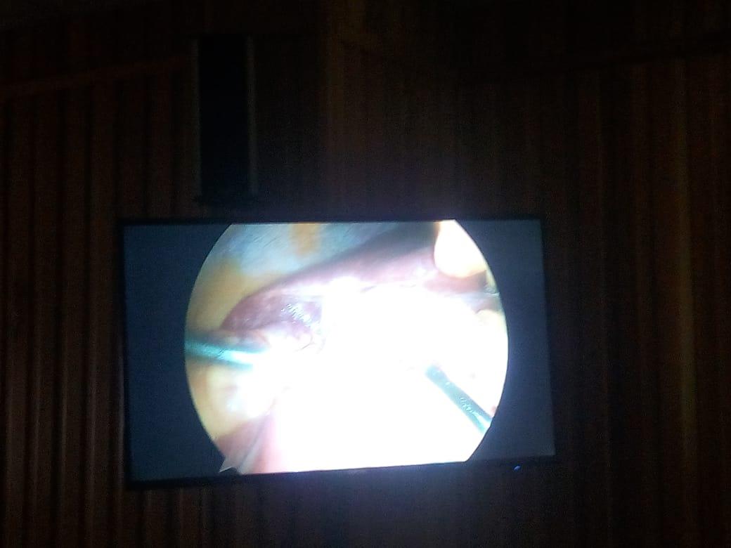 بث أجراء العملات الجراحية عبر شاشة تلفزيونية للأطباء                                                                                                                                                    