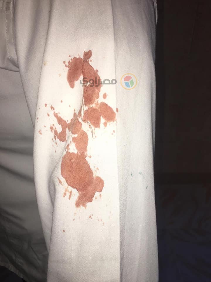 اثار الدم على ملابس الطالبة                                                                                                                                                                             