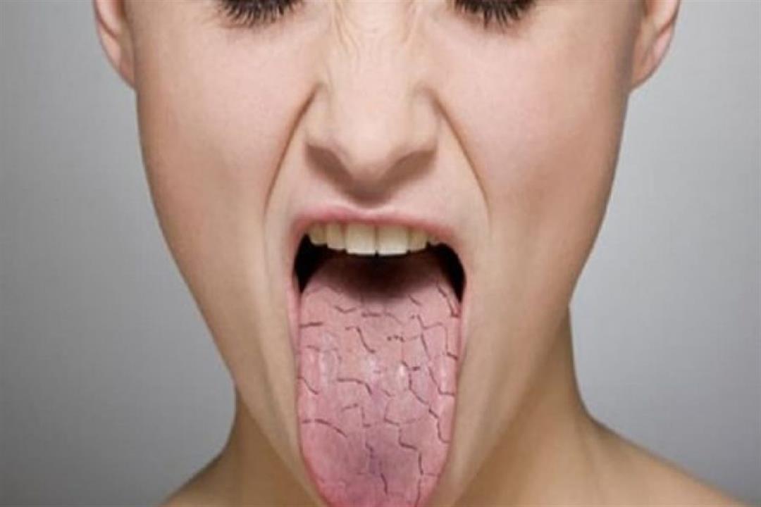 ما أسباب جفاف الفم لدى كبار السن؟