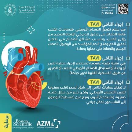 قسطرة القلب دون جراحة (1)