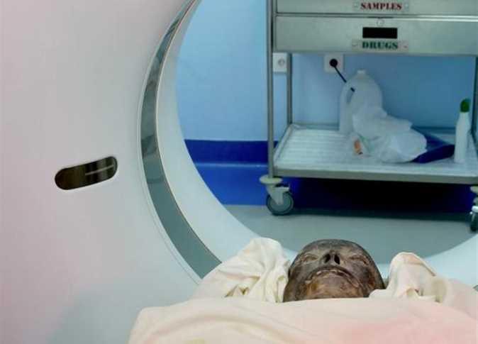 زاهي حواس يجري فحصا لمومياء فرعونية بمستشفى شفاء الأورمان بالأقصر