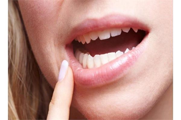طرق الوقاية من سرطان الفم
