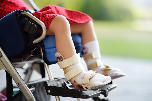 شلل الأطفال يثير القلق في الولايات المتحدة شلل الأطفال يثير القلق في الولايات المتحدة