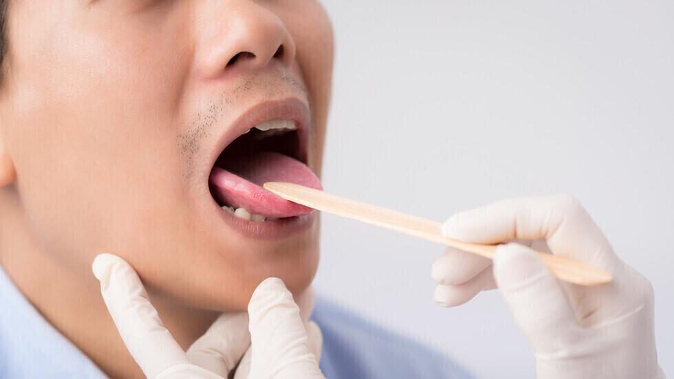  علامات في فمك تشير إلى ارتفاع مستوى السكر في الدم 