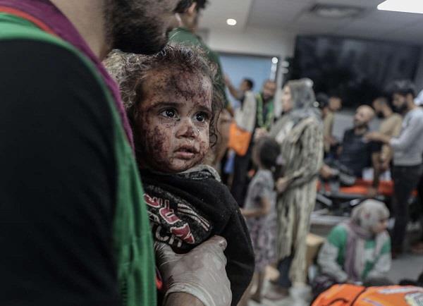طفلة فلسطينية ناجية من مجزرة مستشفى المعمداني، 17 أكتوبر 2023 (وكالات)