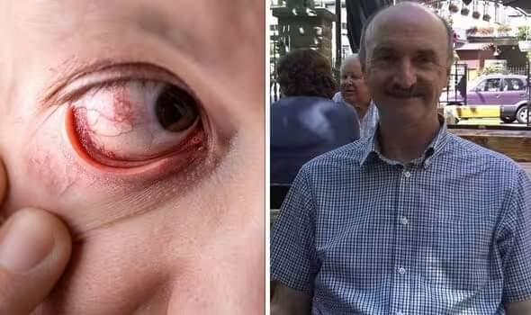 رجل يصاب بالعمى لمدة عام لسبب غير متوقع 