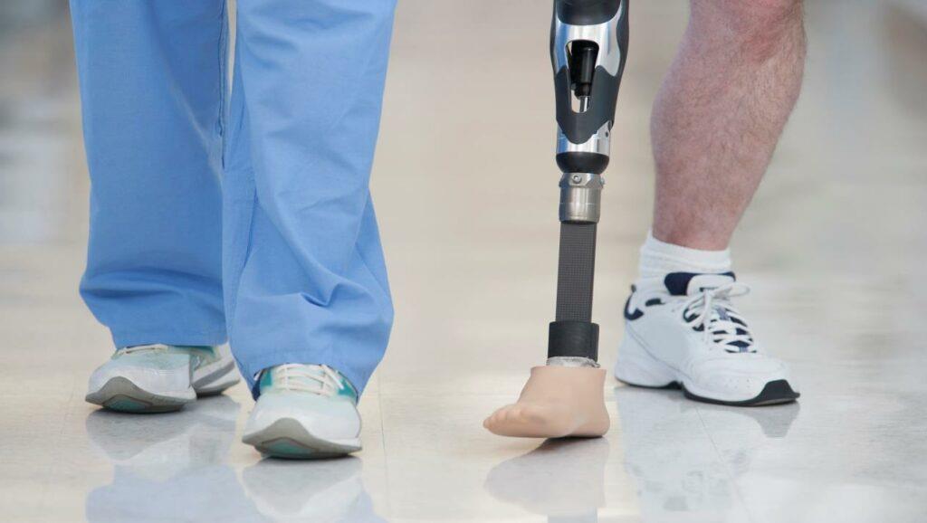 معجزة علمية.. تجربة تفتح باب الأمل لإعادة نمو الأطراف البشرية المبتورة معجزة علمية.. تجربة تفتح باب الأمل لإعادة نمو الأطراف البشرية المبتورة