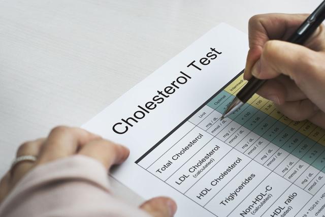 اختبار الكوليسترول
