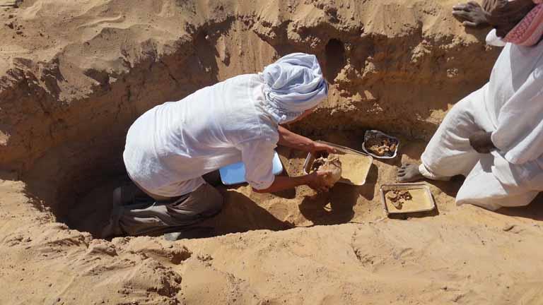 أقدم حالة التهاب مفاصل روماتويدي في مصر (2)