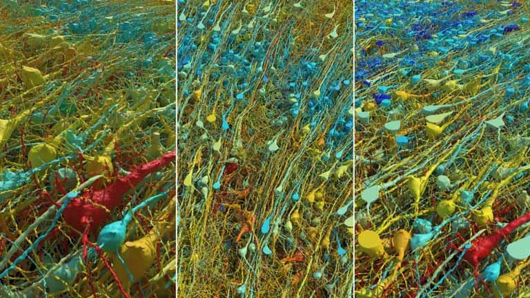 3 صور للخلايا العصبية المثيرة بدرجات متفاوتة من التكبير والميل