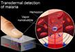 وسيلة جديدة لكشف الملاريا في ثوان