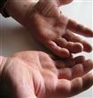 إكزيما اليد ليس لها صورة مرضية موحدة