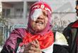 بالصور..أم وليد: فقدت عيني في عهد مرسي.. والأخرى ف