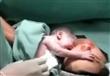 فيديو لطفل يعانق أمه فور ولادته يحقق 3 مليون مشاهد
