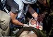 صحفي روسي يصاب بجروح بالغة بعد سيره على لغم 