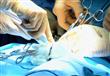 طريقة جراحية جديدة لتركيب مفصل الفخذ الاصطناعي