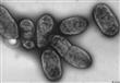 كيف تحولت بكتيريا الطاعون إلى وباء فتاك؟
