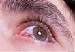 نصائح بسيطة لوقاية العين من الأمراض