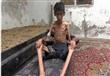 مجاعة مضايا السورية                                                                                                                                                                                     