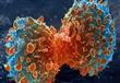 4 وظائف تحفز الأورام السرطانية ... اكتشف