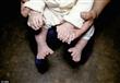طفل صيني يولد بـ 31 أصبعًا في يديه وقدميه (4)                                                                                                                                                           