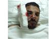 المواطن المصري المصاب بطلق ناري عن طريق الخطأ