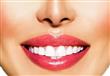 طبيب أسنان: الأساليب الشعبية المستخدمة في تبييض ال