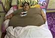المصرية إيمان تفقد 40 كيلوجراما من وزنها في سبعة أ