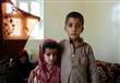 طفلين يمنيين من ضحايا الحرب الأهلية