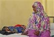 صومالية مع طفلها الذي يعاني من سوء التغذية في مركز