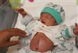 بالصور- إنقاذ رضيع ولد بأمعاء خارجية (4)