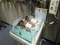  الأطفال الرضع يصارعون من أجل البقاء في مستشفى غزة