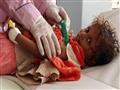 أغلب المصابين بالكوليرا في اليمن أطفال يعانون أصلا